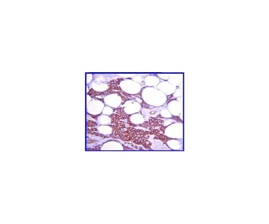 62-8387-80 Anti-IκBα; 100 μL 07-1483