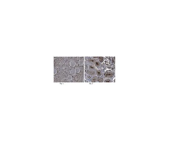 62-8456-74 Anti-CCN1/CYR61 ABC102