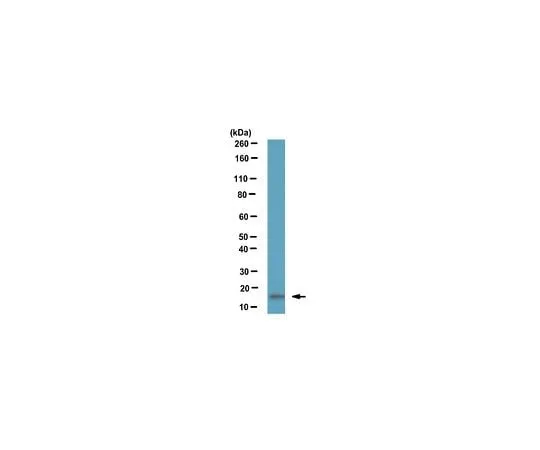 62-8458-15 Anti-LC3B ABC432