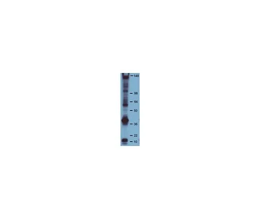 62-8392-85 Anti-Phosphotyrosine, clone PY20, HRP Conjugate; 10 blots 16-454
