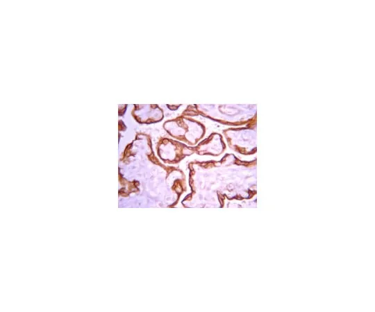 62-8374-23 Anti-Insulin-like Growth Factor-I Receptor, β-subunit, clone 1-2; 100 μg 05-1106