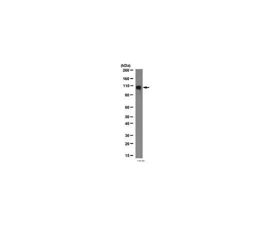 62-8387-45 Anti-ECT2; 100 μg 07-1364