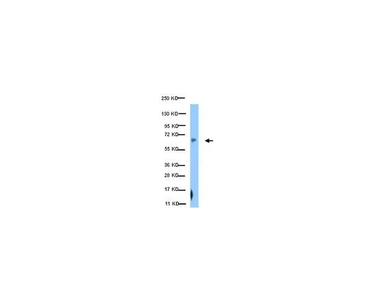 62-8387-70 Anti-phospho-Paxillin (Ser126); 100 μL 07-1441
