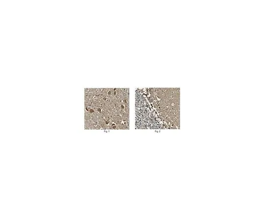 62-8465-50 Anti-S100B Antibody Cat. No. ABN59 ABN59