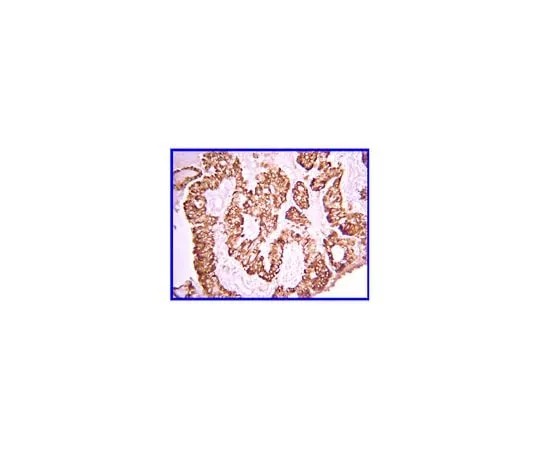 62-8387-68 Anti-PDGF-AA; 100 μL 07-1436