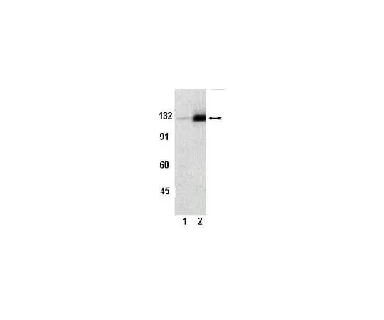 62-8386-75 anti-phospho-FAK (Tyr861); 100 μL 07-832