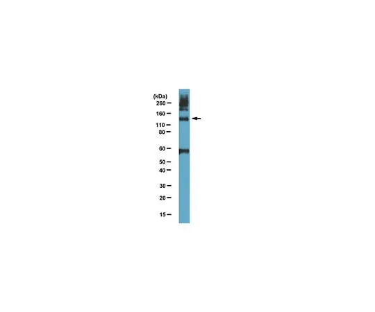62-8387-67 Anti- Tie-2, N-terminus; 50 μg 07-1431