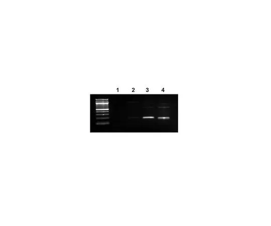 62-8393-35 EZ-Magna ChIP(TM) A Chromatin Immunoprecipitation Kit; 22 assays 17-408