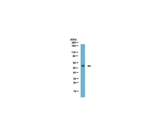 62-8465-85 Anti-RGS11 (C-terminus); 100 μg ABN111