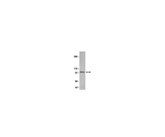 62-8384-53 Anti-NR3B; 200 μg 07-351