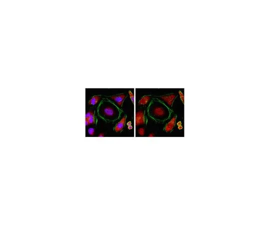 62-8453-88 Anti-TNRC6B; 100 μg AB9913