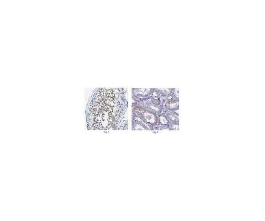 62-8462-97 Anti-E3 ubiquitin-protein ligase UHRF2 Antibody ABE1028