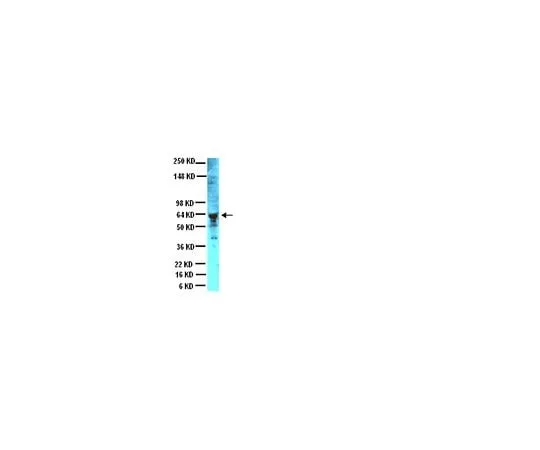 62-8445-11 Anti-Peripherin; 100 μL AB1530