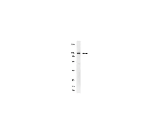 62-8370-97 Anti-α-Actinin, clone AT6/172; 200 μg 05-384