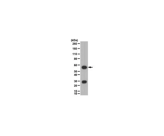 62-8383-65 Anti-Calcineurin A/PP2B catalytic unit 07-068-I