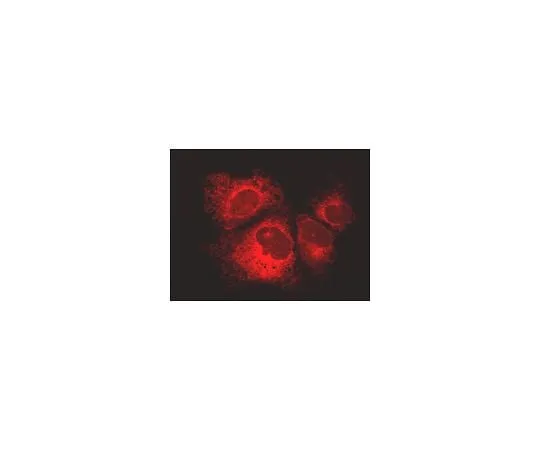 62-8394-32 LentiBrite(TM) Calreticulin-RFP-KDEL Lentiviral Biosensor 17-10146