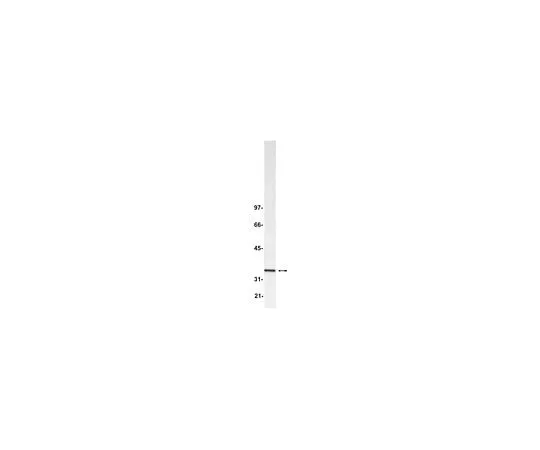 62-8383-89 Anti-Blys/TALL-1/BAFF/THANK; 100 μg 07-167