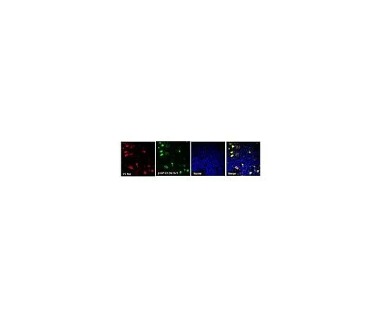 62-8468-16 Anti-C9ORF72/C9RANT (GPsense-CT) ABN1357