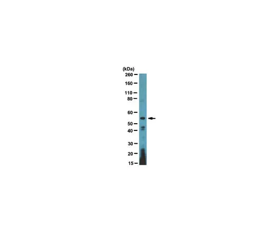62-8369-35 Anti-ETS1 DBD, clone 1ET 7F2; 100 μg 04-1542