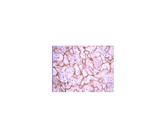 62-8387-66 Anti-VEGF; 50 μg 07-1420