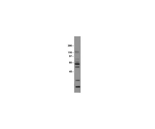62-8384-91 Anti-dimethyl-Arginine, asymmetric (ASYM24); 200 μL 07-414