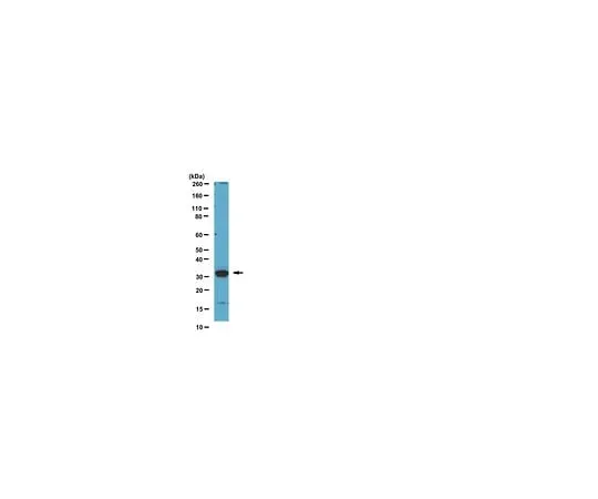62-8454-39 Anti-Kallikrein-3 (KLK3) (C-term); 100 μg AB10428