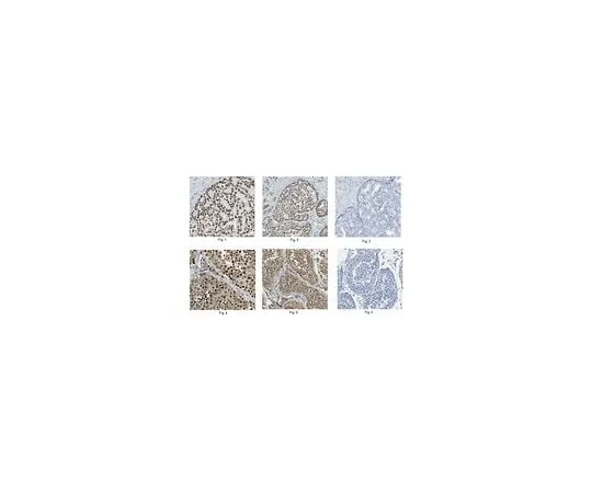 62-8462-20 Anti-Ku70 Protein Antibody , Cat. No. ABE558 ABE558