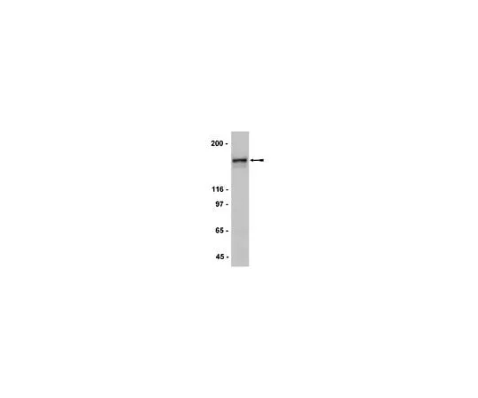 62-8386-01 Anti-NR2A; 200 μg 07-632