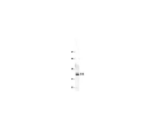 62-8382-10 Anti-LAT; 400 μg 06-807