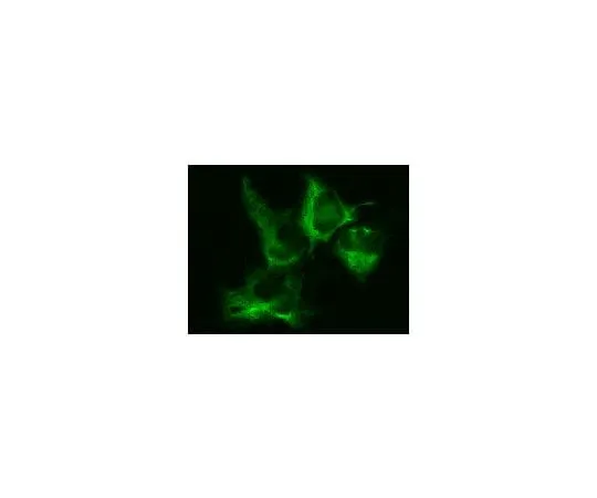 62-8394-35 LentiBrite(TM) GFP-Vimentin Lentiviral Biosensor 17-10152