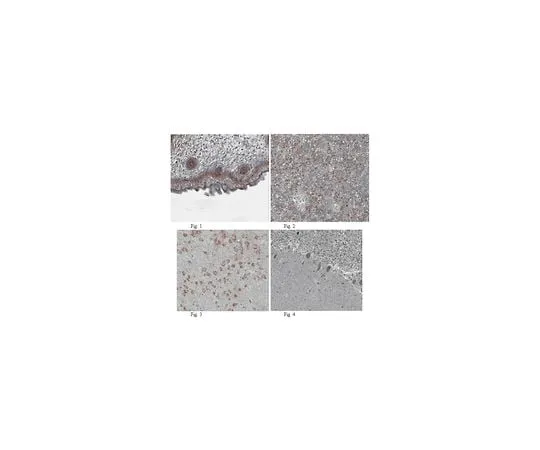 62-8465-43 Anti-FGF10; 100 μg ABN44