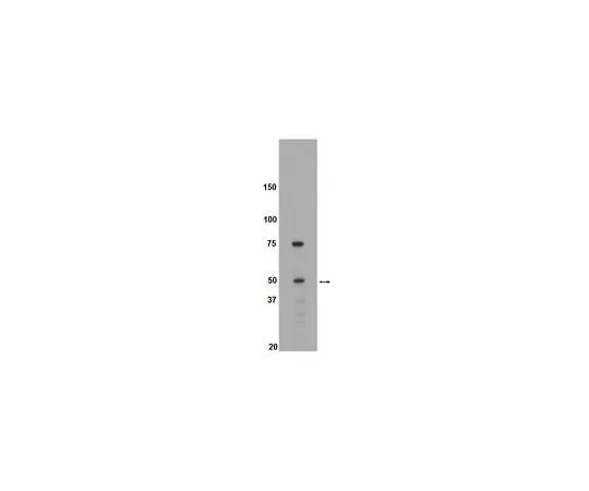 62-8389-38 anti-Brk; 50 μg 09-143