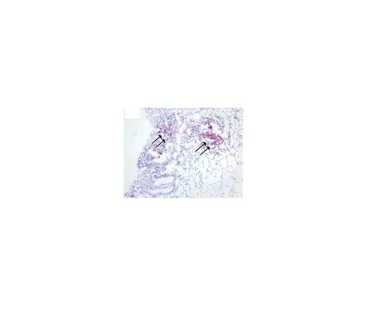 62-8453-50 Anti-S100A12; 100 μg AB9728