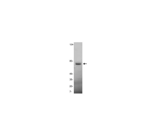 62-8373-46 Anti-Vitronectin, clone GMA-900; 100 μg 05-860