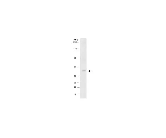 62-8368-51 Anti-Src, CT, clone NL19; 100 μL 04-772