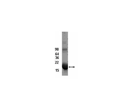 62-8391-66 UbcH5b Conjugating Enzyme; 100 μg 14-810
