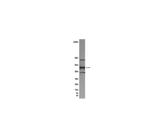 62-8393-52 ChIPAb+ LEF1; 25 assays 17-604