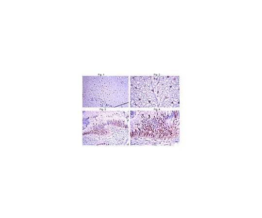 62-8454-80 Anti-Glycine Receptor alpha3 subunit ; 100 μg AB15014