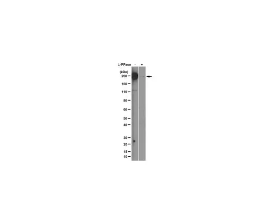 62-8369-50 Anti-RNA polymerase II subunit B1 (phospho-CTD Ser-5), clone 3E8; 100 μg 04-1572