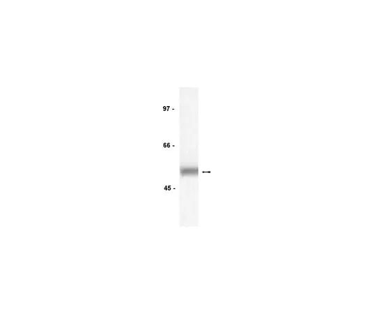 62-8371-17 Anti-Lck, clone 3A5; 100 μg 05-435