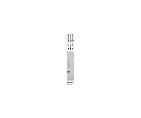 62-8450-17 Anti-Synuclein, gamma; 50 μL AB5466