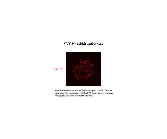62-8464-36 Anti-SYCP2 ABE2622