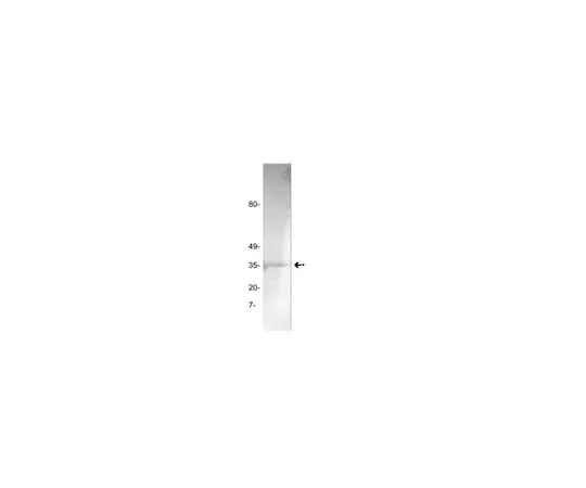 62-8373-52 Anti-Thrombin, clone GMA-020; 100 μg 05-880