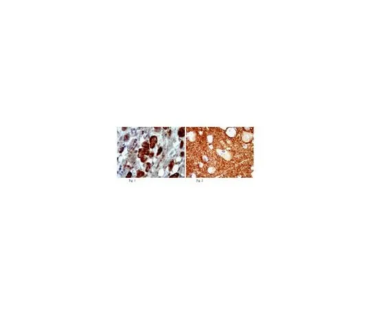 62-8465-56 Anti-Cholesterol acyltransferase 1; 100 μg ABN66