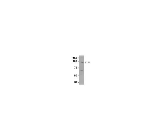 62-8386-25 Anti-EZH2; 200 μL 07-689