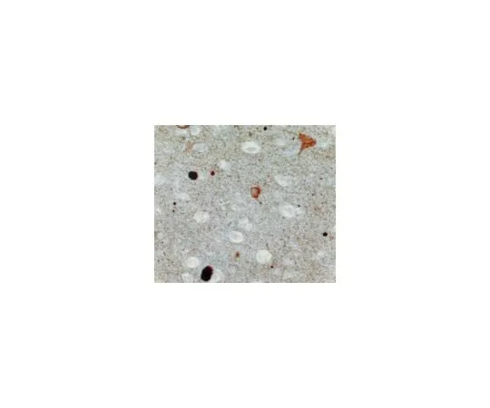 62-8449-03 Anti-Synuclein, alpha; 20 μg AB5038P