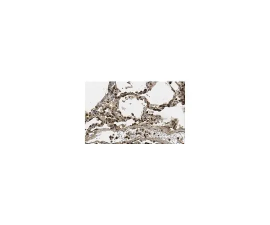 62-8453-48 Anti-RAGE AB9714-I