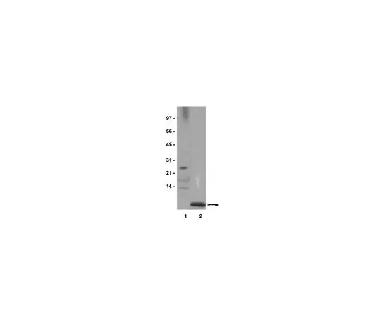 62-8384-72 Anti-Ubiquitin; 200 μg 07-375
