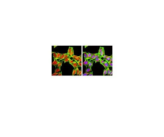 62-8387-40 Anti-PHLPP1; 100 μg 07-1341