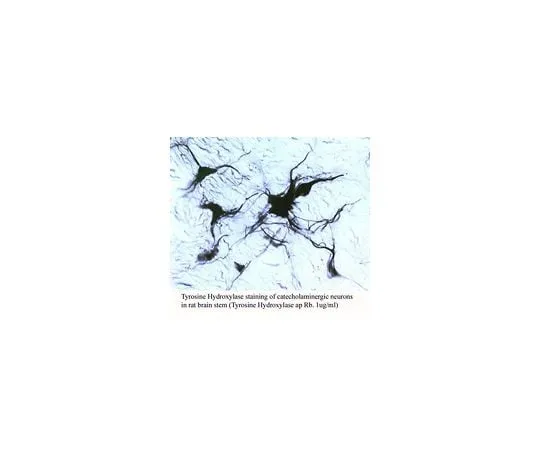 62-8452-16 Anti-Tyrosine Hydroxylase; 50 μg AB5986P